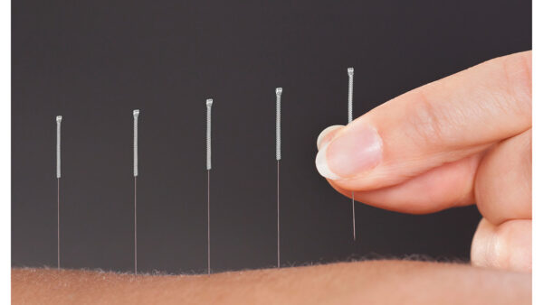 Acupuncture for chronic neck pain